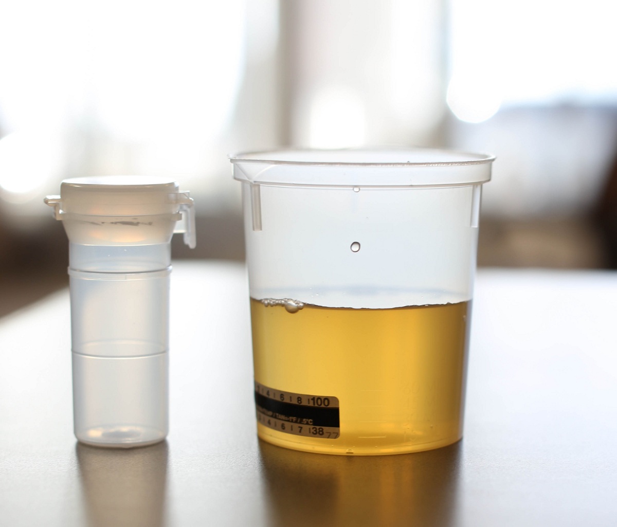 Ways To Keep Synthetic Urine Warm For Drug Testing