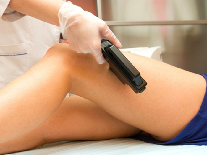Varicose Veins can be effectively treated and Removed