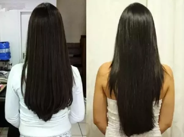 Bringing Your Hair Growth To Normal Is Not As Tough As You Think of It — Here Is Why?