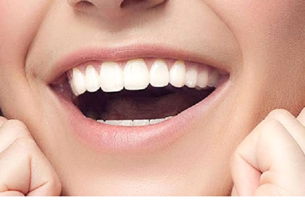 Maintain your healthy happy Smile with Veneers