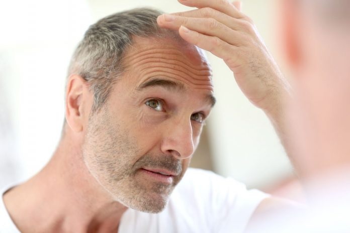 How Effective Is Procerin For Hair Loss?