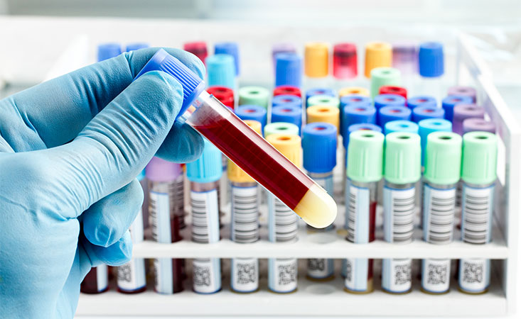 Effective Techniques To Phlebotomy: The Procedure You Should Follow