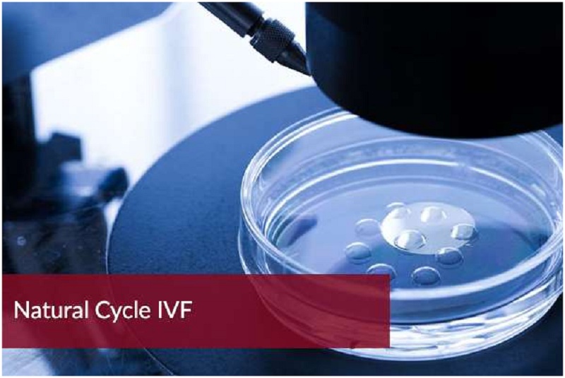 Prepare IVF: Good organisation in advance
