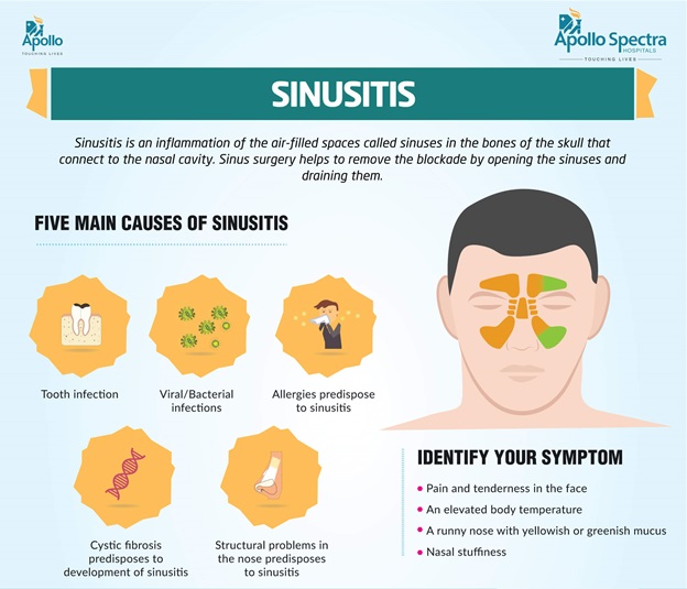 What is Sinus Infection When to See a Doctor?