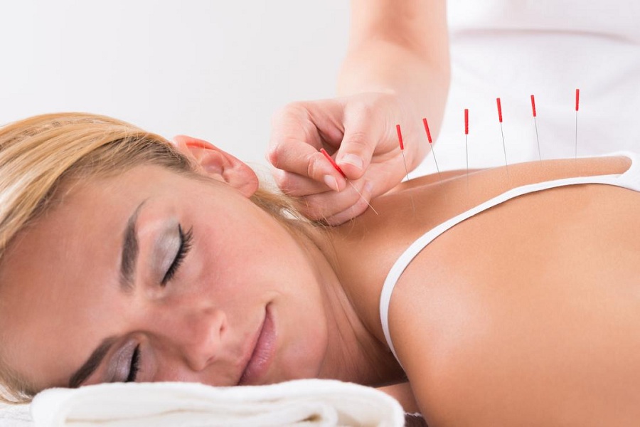 Benefits of Acupuncture