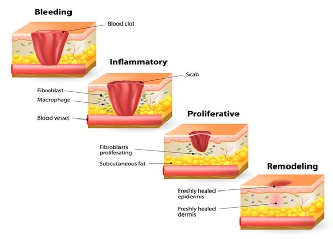      Can You Boost Up The Healing Process Of Your Skin And Wounds