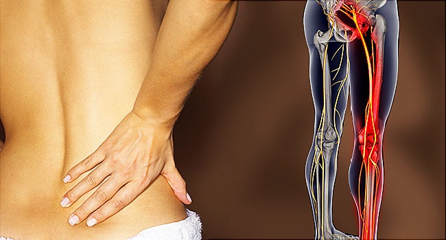 Brief Understanding of Sciatica and the Best Treatment for it