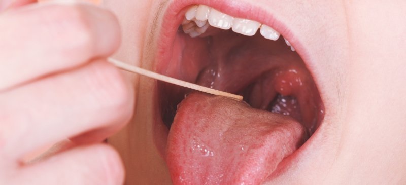 Adults can get tonsillitis as well