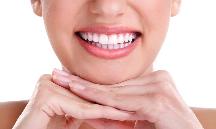 Things You Got to Know Before Using Teeth Whitening?