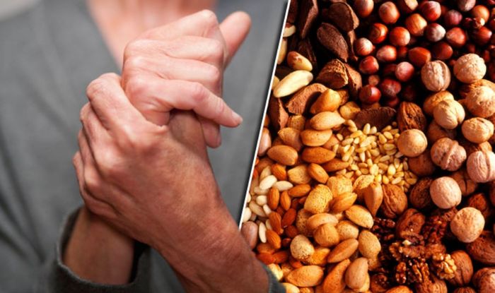 5 foods you must consume to prevent Arthritis pain