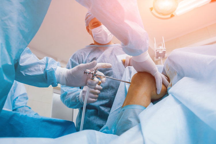 Knee arthroscopy- Meaning, complications, and role of expert witnesses