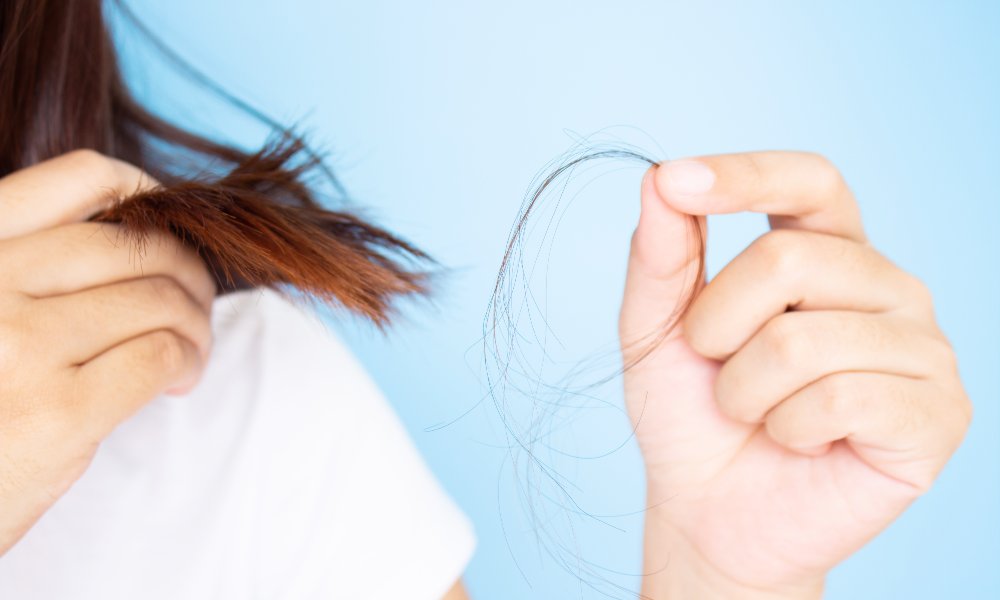 What are the causes of hair fall in women