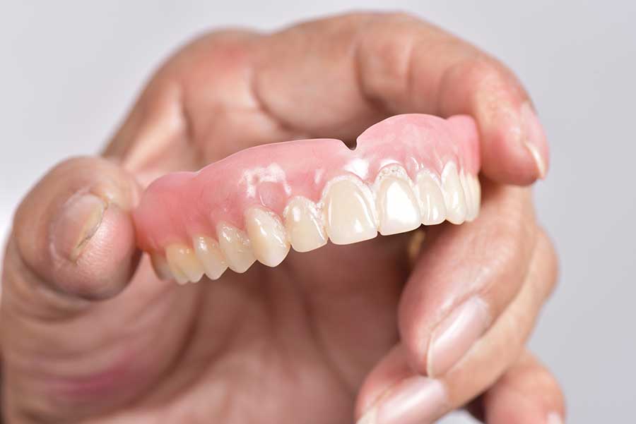 Full and Partial Dentures: A Comprehensive Guide to Your Smile Restoration Options